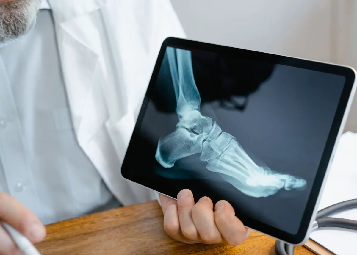 This is a photo of a doctor holding a tablet that's showing an x-ray of a foot.