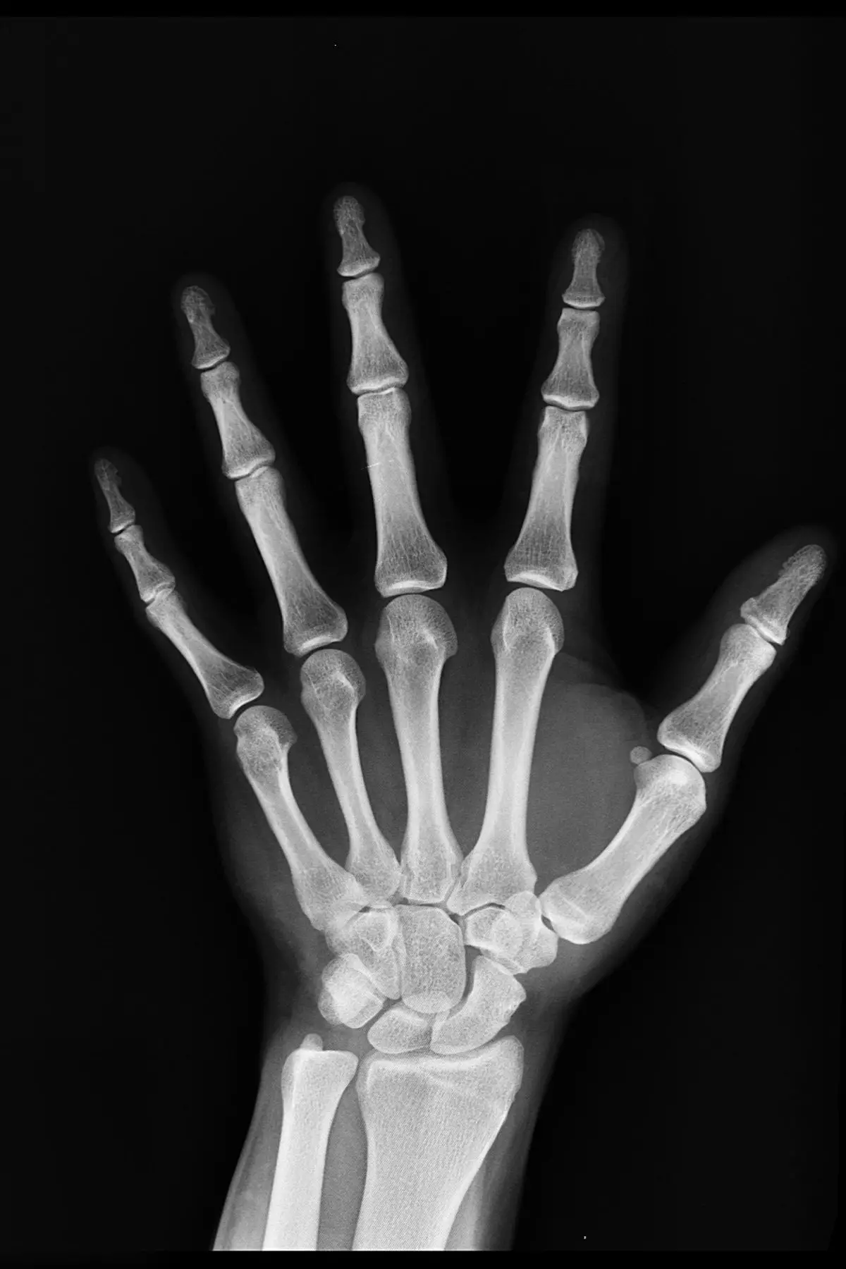 This is a photo of an x-ray of an adult hand.  